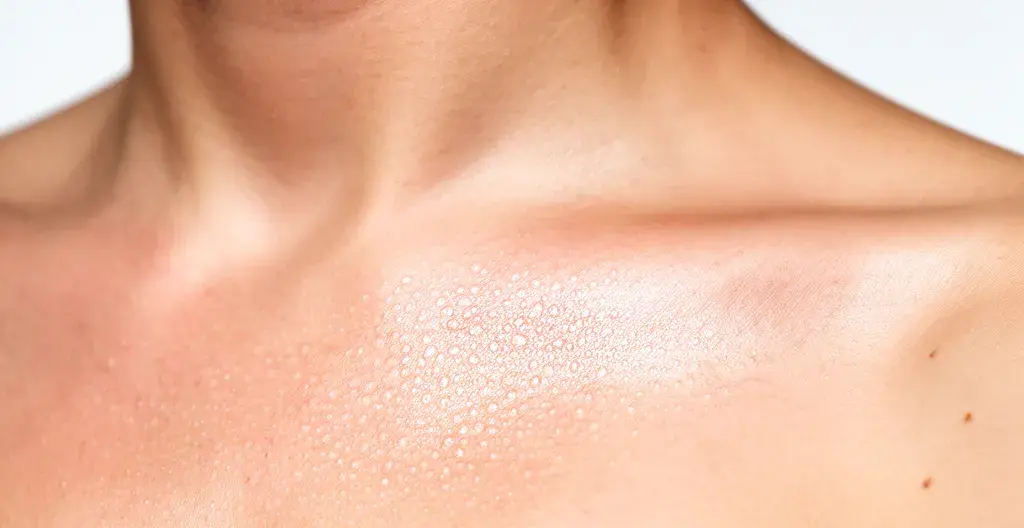 Texture de peau naturelle épaule montrant hydratation après cure collagène marin